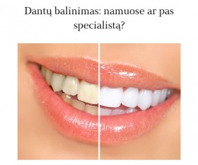 Dantu balinimas